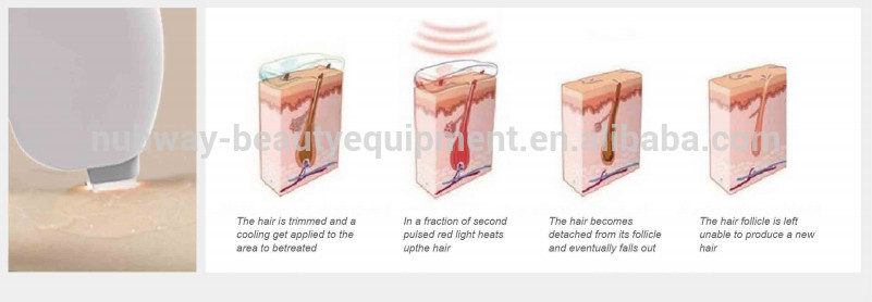 2015 NUbway Newest professional 808nm diode laser /diode laser hair removal/ diode laser 808 beauty device