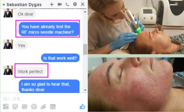 Scars and Ance removal / wrinkle removal/ /face lifting/ Skin rejuvenation