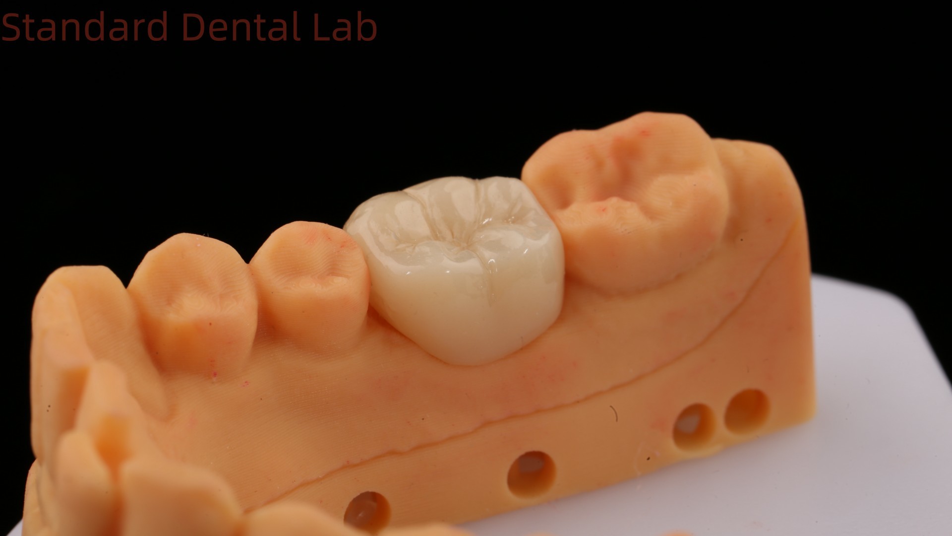 Translucency Zirconia Dental Inlay Onlay Crown For Restore Natural Cavity Shape / Standard Dental Lab