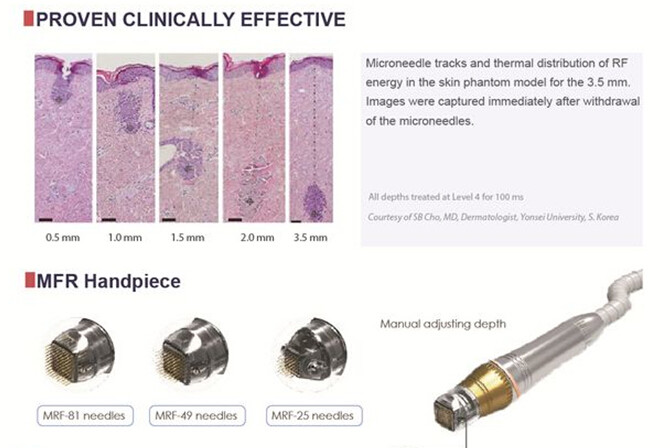 Scarlet microneedle rf radio frequency fractional skin resurfacing max rf skin treatment