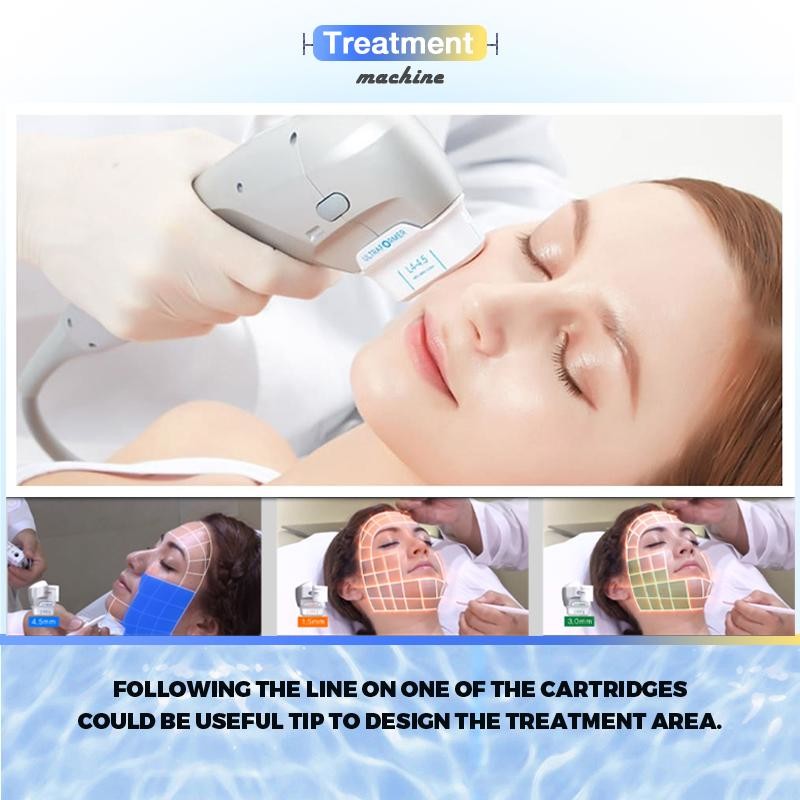 7D Skin Rejuvenation Hifu Beauty Machine High Intensiy Foused Ultrasound