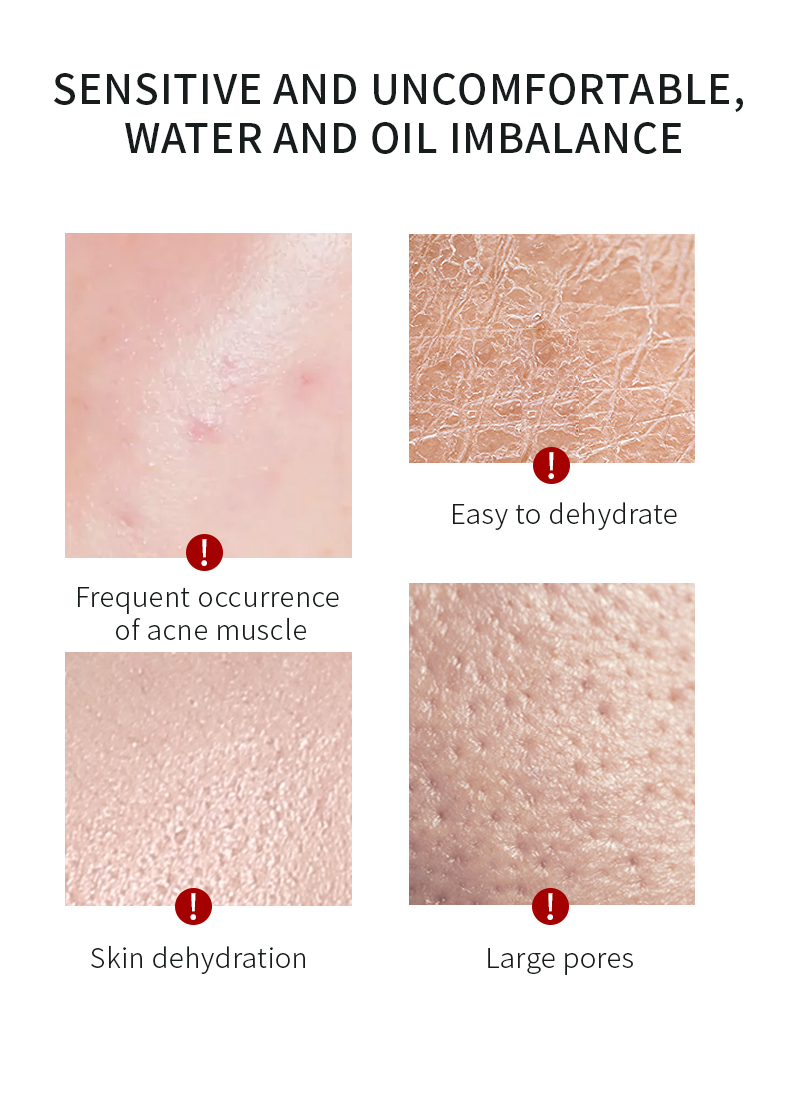 Marigold Petal Facial Clay Mask For Pores PEARL Hyaluronic Acid Glycerin