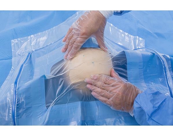 BEST PRICE Medical Sterile Craniotomy Drape Pack in Brain Neuro surgery