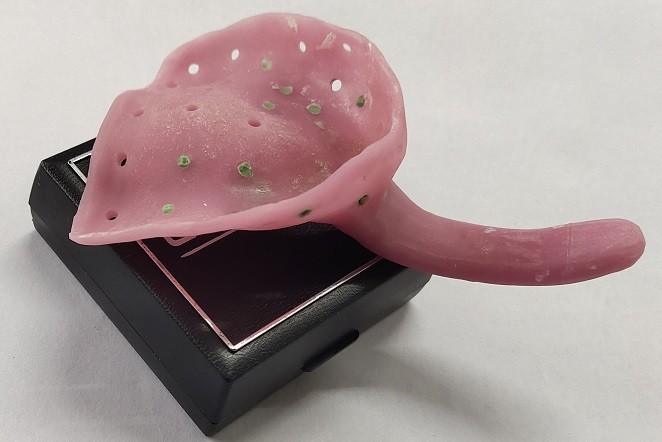 Custom Denture Impression Trays