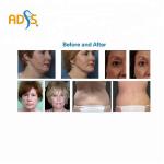 OEM Salon Thermage RF Machine Skin Tightening Slimming Beauty Equipment