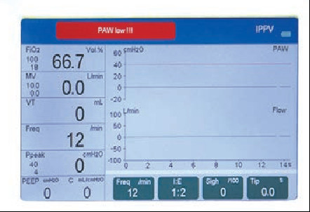 S6500 7" Screen Anesthesia System 25L/Min-75L/Min Anesthesia Workstation