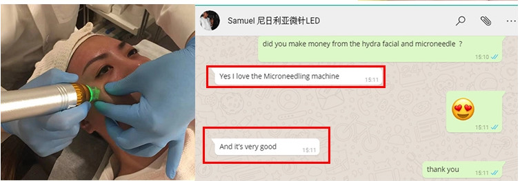 stretch mark removal rf fractional rf microneedle machine