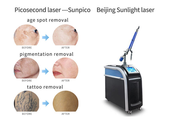 High - Tech Picosure Tattoo Removal Machine 755 Nm Handpiece For Skin Lifting