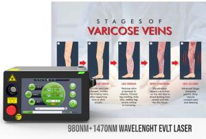 China Harlas EVLT Laser Machine 1470nm Varicose Veins Medical Devices wholesale