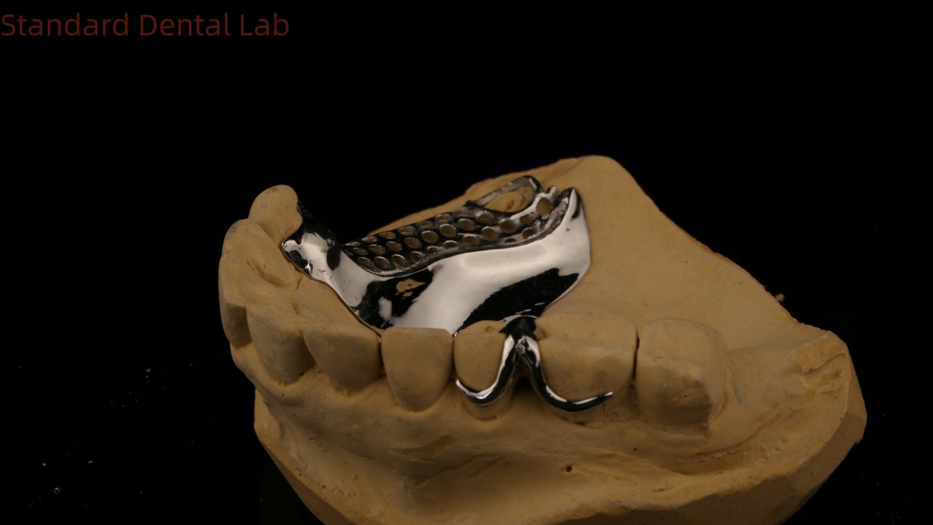 High Strength 3D Printed Cast Framework COCR Partial Dentures Chrome Cobalt Cast Metal Framework