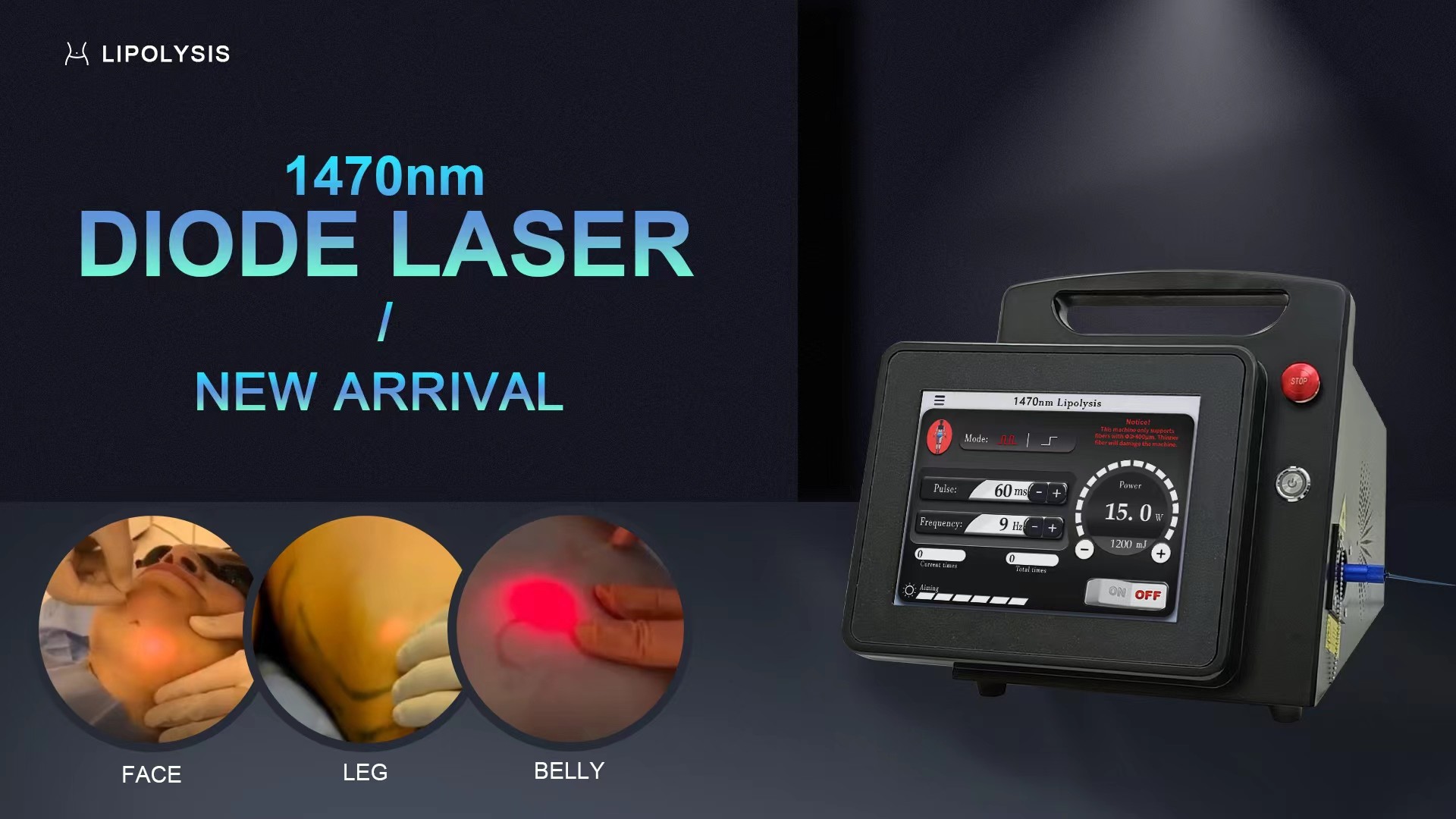 Advanced Diode Laser Lipolysis Machine For Targeted Fat Reduction In Abdomen To Arms 30-60 Min Treatment Time
