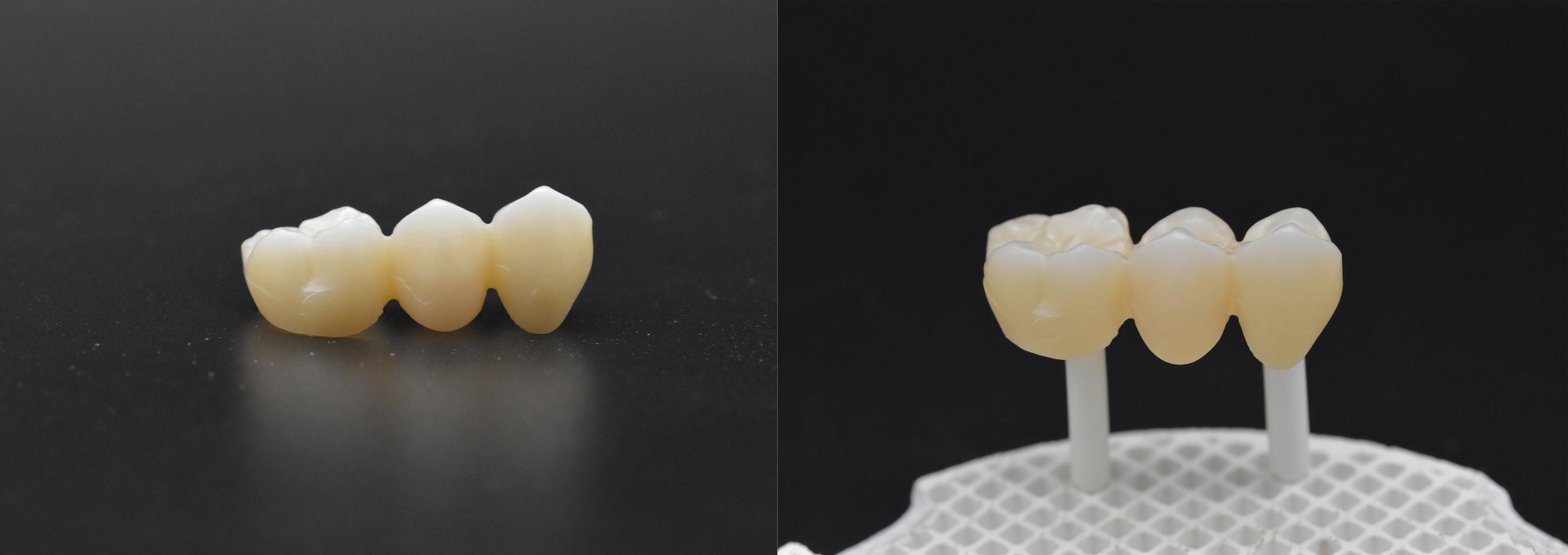 1500 ℃ UT Multilayer 600MPA Dental Zirconia Blocks