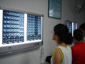 China 10in X 12in X Ray Dry Film wholesale