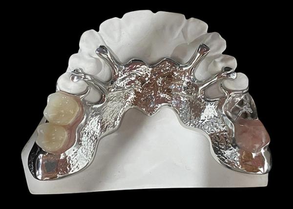 Customizable Cast Partial Removable Denture With Acrylic Resin / Metal Base