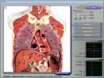 3d Mra / 3d Nls Quantum Resonance Health Analyzer Machine