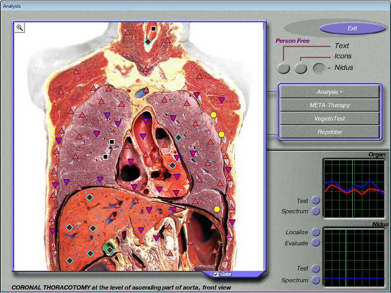 Quantum Magnetic Resonance 3d Nls Health Analyzer , Win XP Win 7