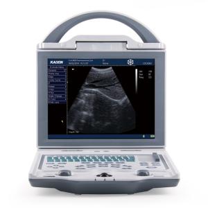 China Diagnostic Medical Ultrasound Machine KX5600 Ultrasound Machine Full Digital B Mode wholesale
