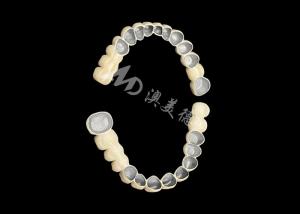 China Customized Porcelain Fused To Metal Dental Crown Bridge For Natural Smile Enhancement wholesale