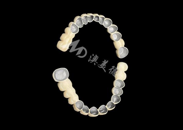 Customized Porcelain Fused To Metal Dental Crown Bridge For Natural Smile