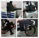 best selling Light spot 0.1mm USA fractional CO2 laser scar/ acne removal skin