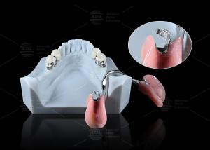 China Sleek Precision ERA Dental Attachments For Universal Secure Dental Prosthetics wholesale