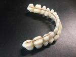 Denture Repair Dental Acrylic Resin Teeth Kit Artificial Synthetic Resin