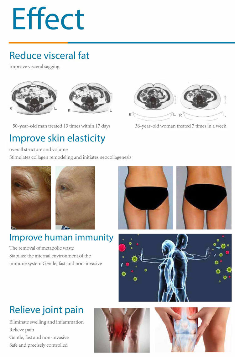 RET 448hz Tecar Pain Relief Device , RF Body Skin Tightening Machine