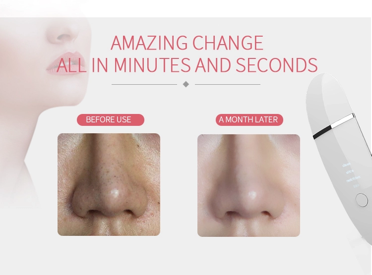 Ultrasonic skin scrubber facial equipment home use beauty device