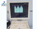 Aloka Image Bright Channel Interference Ultrasound Machine Repair RDBF Board