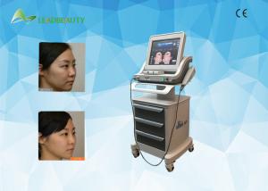 China Ultrasonic HIFU Face lift photo rejuvenation body slimming machine wholesale