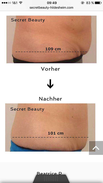 Beautiful Design High Quality Manufacturer Direct Sale Portable Cryolipolysis Machine For