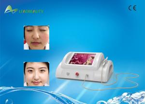China 30MHz RBS beauty machine laser blood vessel skin tag removal device wholesale