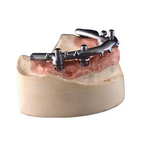 China All-On-4 Titanium CNC Implant Secured Dentures For Dental Clinic wholesale