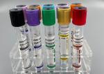 ODM Blood Vacuum Container Gray Blood Collection Tube Sodium Fluoride Tube For
