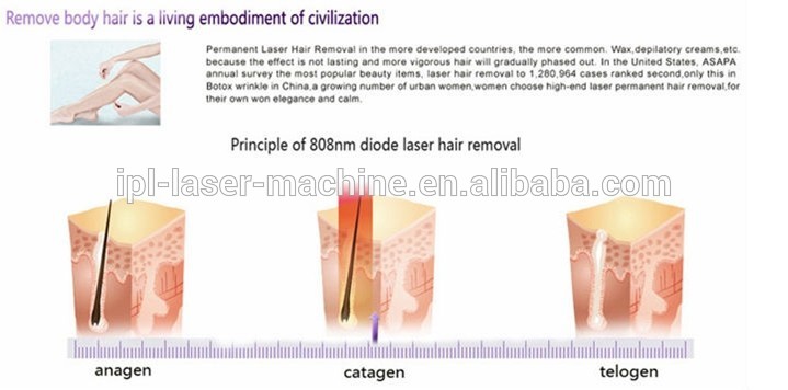 Permanent diode laser hair removal machine for Spa or Salon use