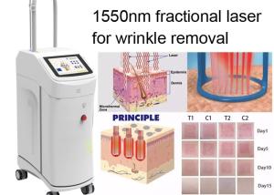 China 120mJ 1550nm Wrinkle Laser Machine CE Skin Tightening Laser Machine wholesale