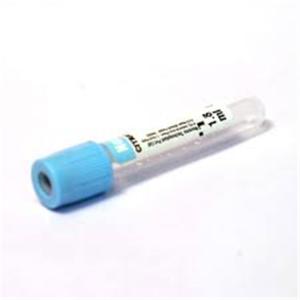 China Serum Light Blue Top Edta Blood Test Tube Serum Separator wholesale