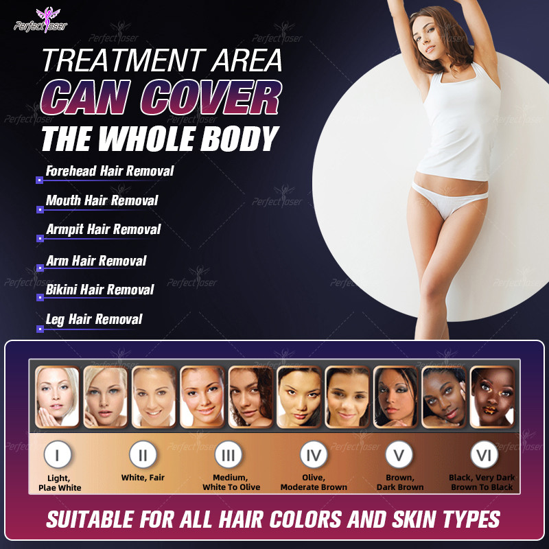 300000 Shots Laser Face Lift Machine 2500W OPT SHR IPL Hair Removal Machine