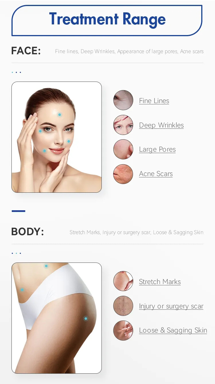 Wrinkle Removal Secret RF Machine