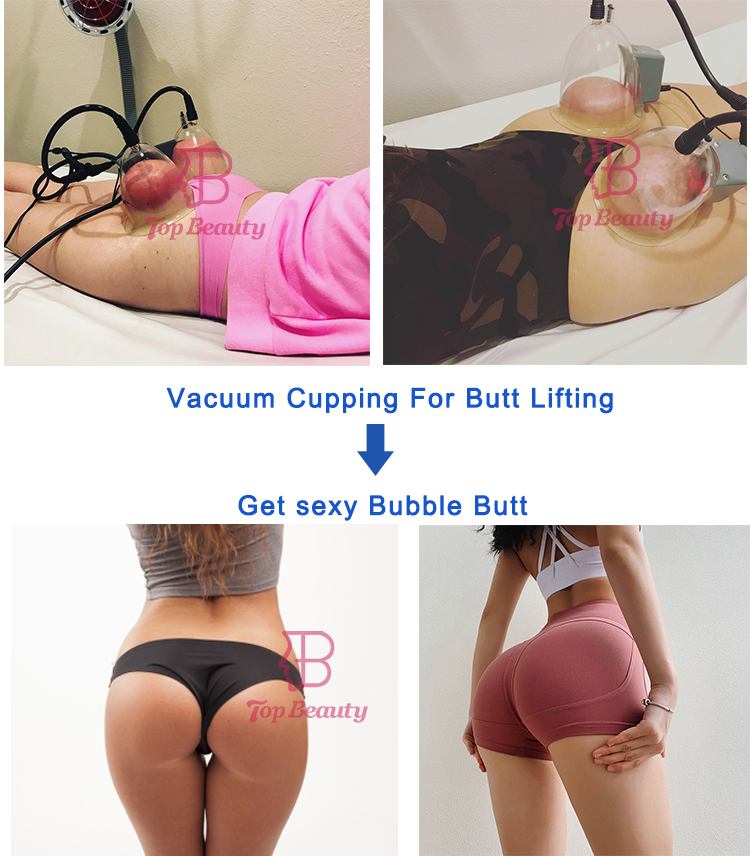 Portable Buttock Lift Vacuum Butt Lifting Machine Vacuum Therapy Xl Cups
