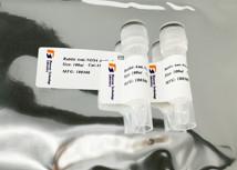 China Highly Sensitive Atriopeptidase Anti MME Mouse Monoclonal Antibody wholesale