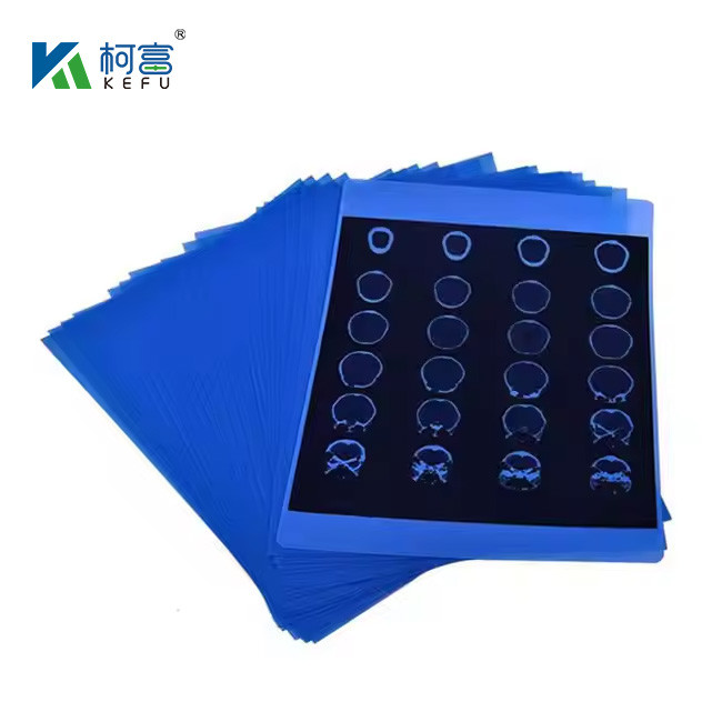 Medical Inkjet Printing Film Professional Production Medical Blue X Ray Film Laser Printing Medical X Ray Film