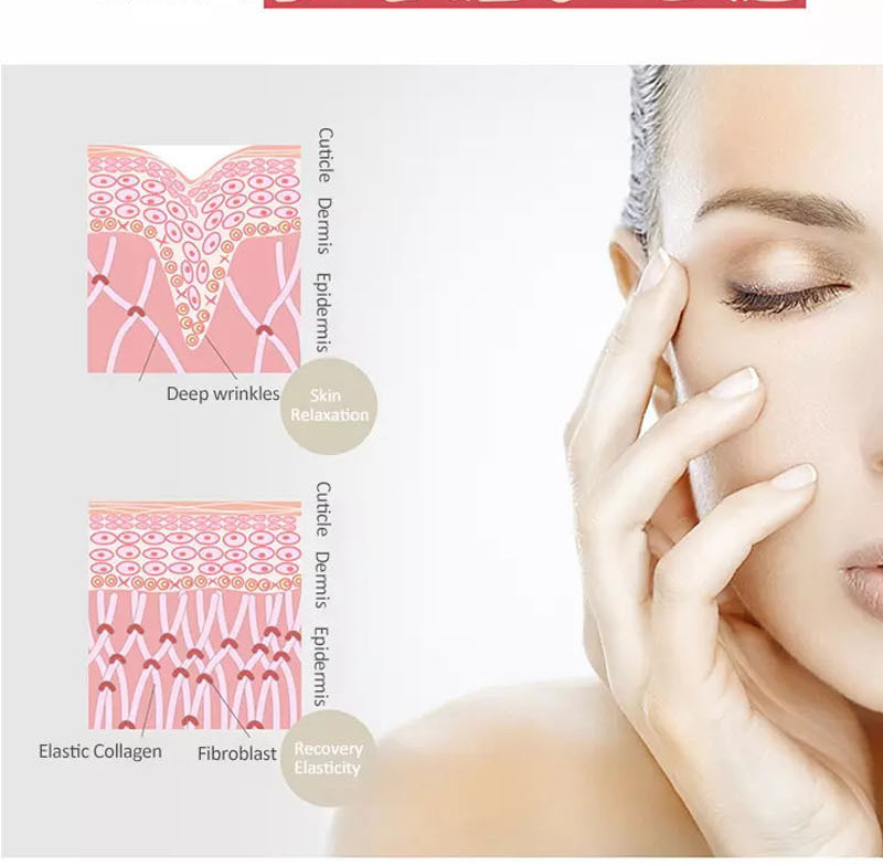 Skin Resurfacing Er Yag Laser Machine Super Penetration Wrinkle Removal Device