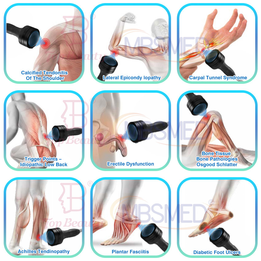 Focus Shockwave Softwave Shock Therapy Tissue Regeneration Machine