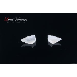 Strong zirconia dental veneers