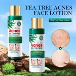 OEM ODM Face Lotion Natural Organic Tea Tree Moisturizer Aging Skin Treatments