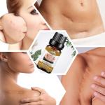 Pure Anti Scar Oil Removing 10ml Facial Scar Essential Oil ODM USDA