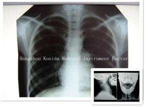 China Digital Medical X Ray Dry Film 14 x 17inch Health Imaging Radiographic Film wholesale