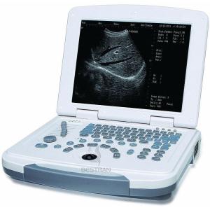 China Laptop Ultrasound Scanner wholesale