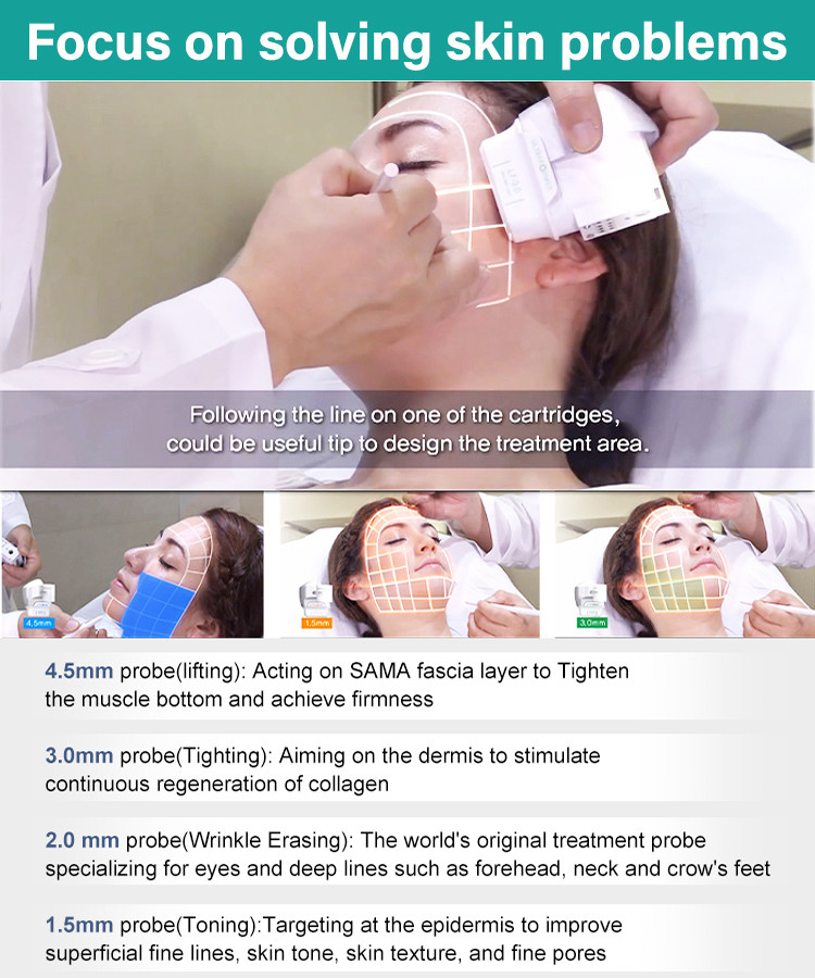 High-intensity Focused Ultrasound with Spot Size of 1-10mm Energy Level of 0.1-3J